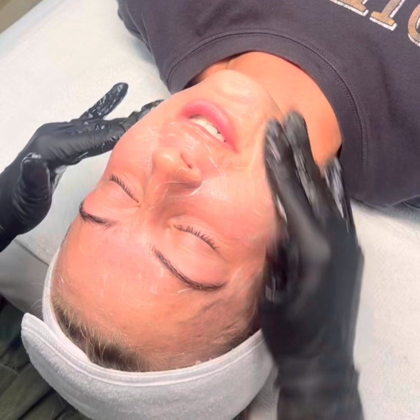 What does a chemical peel do?
